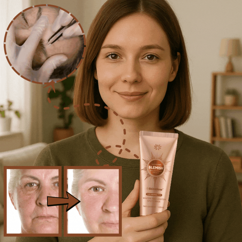 Lunoria® SkinGlow Mask | Tar bort mörka pigmentfläckar med upp till 87 % på bara 7 dagar