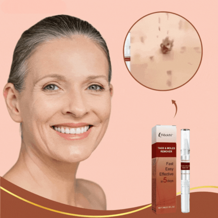 Fläckfri™ Penna | Tar bort vårtor & pigmentfläckar – smärtfritt på bara 3 dagar!