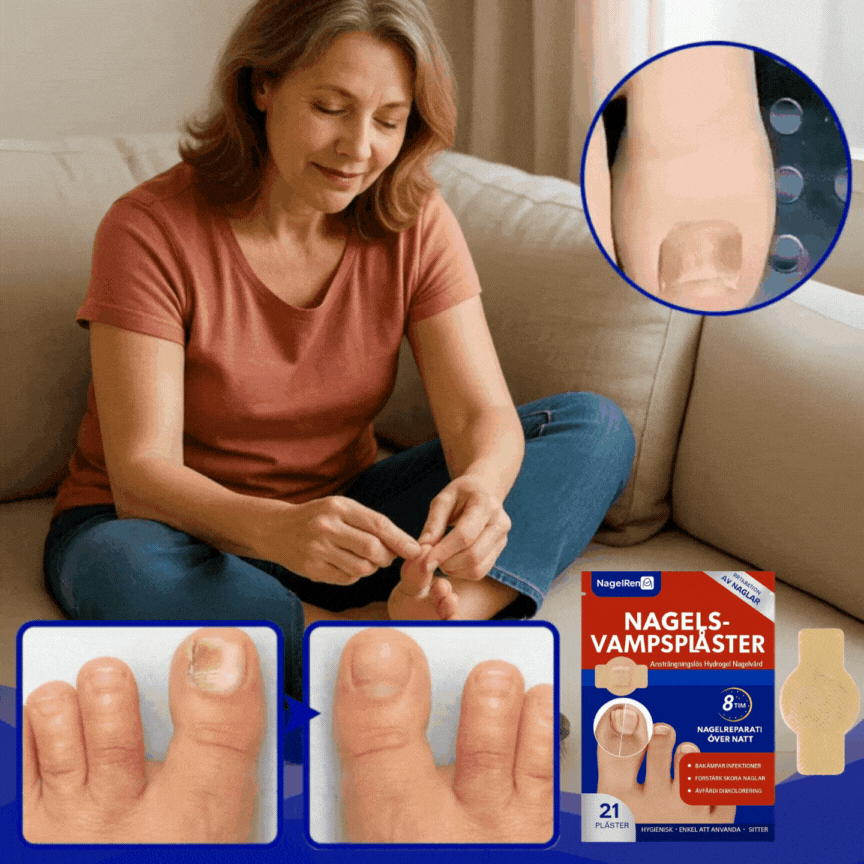 NagelRen™-plåster | Tar bort 98% av envis nagelsvamp på bara 15 minuter!