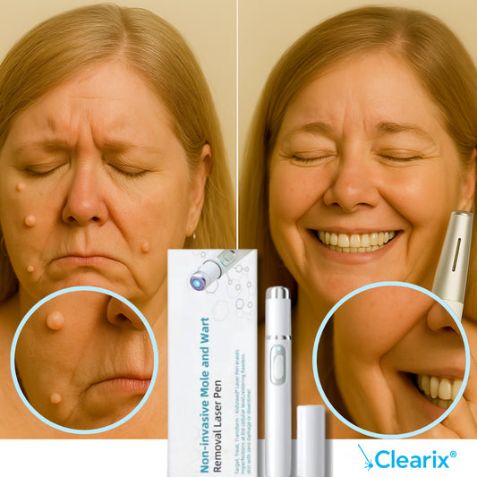 Clearix® | Rensa huden från vårtor, födelsemärken & pigmentfläckar – på 3 dagar